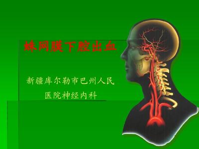蛛网膜下腔出血
