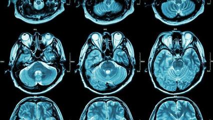 人脑中存在“多维宇宙”,最高可达11维?