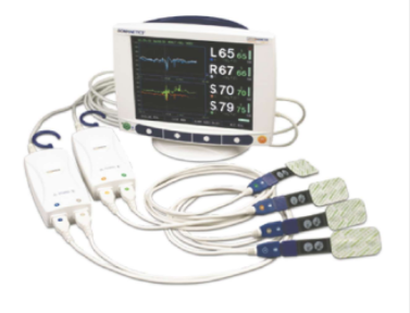 深入了解血氧监测 神经内科的智能守护者